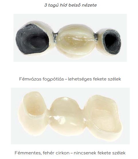 100% fémmentes - CIRKON